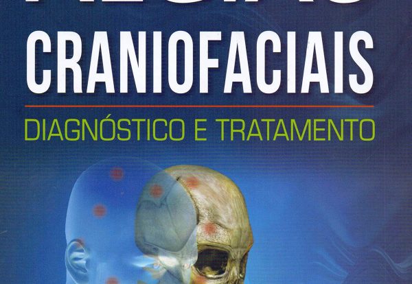 Algias Craniofaciais- Diagnóstico e Tratamento